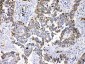 Anti-Periplakin Picoband Antibody